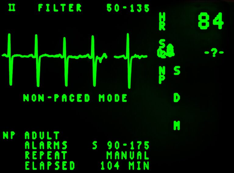 EKG machine