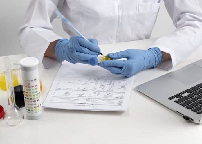 Urine Drug Testing