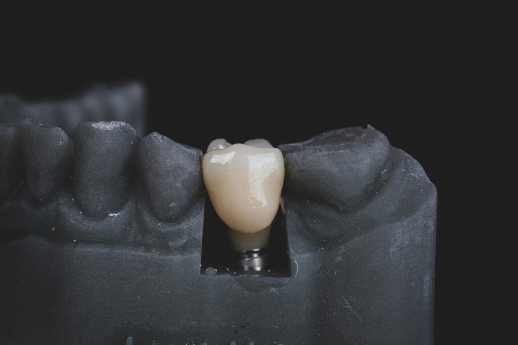 Care for Your Implant